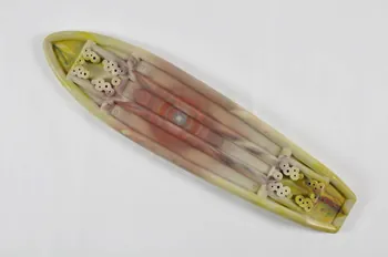 Lotus planche de skateboard Etats-Unis 1975-1979 2000.29.174  Photo Mucem