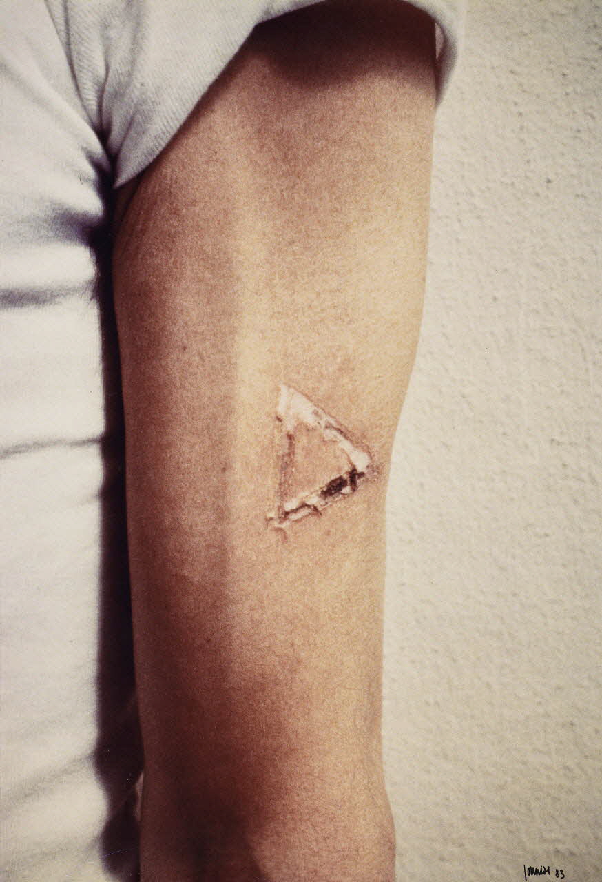 Michel Journiac tirage photographique Marquage d'un corps - Action de corps exclu Ile-de-France, France 1983-1993 2021.9.3 Photo Mucem / Marianne Kuhn