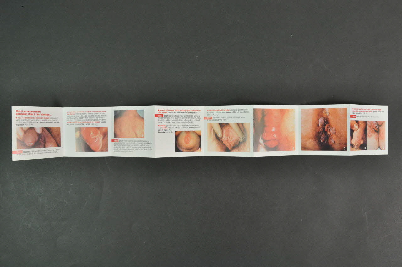 Narodni Program Boje Proti Aids / SZU Dépliant "Praktické informace o pohlavnê prenosnych infekcich / Achjo..!" République Tchèque 2004 2005.114.16  Photo Mucem