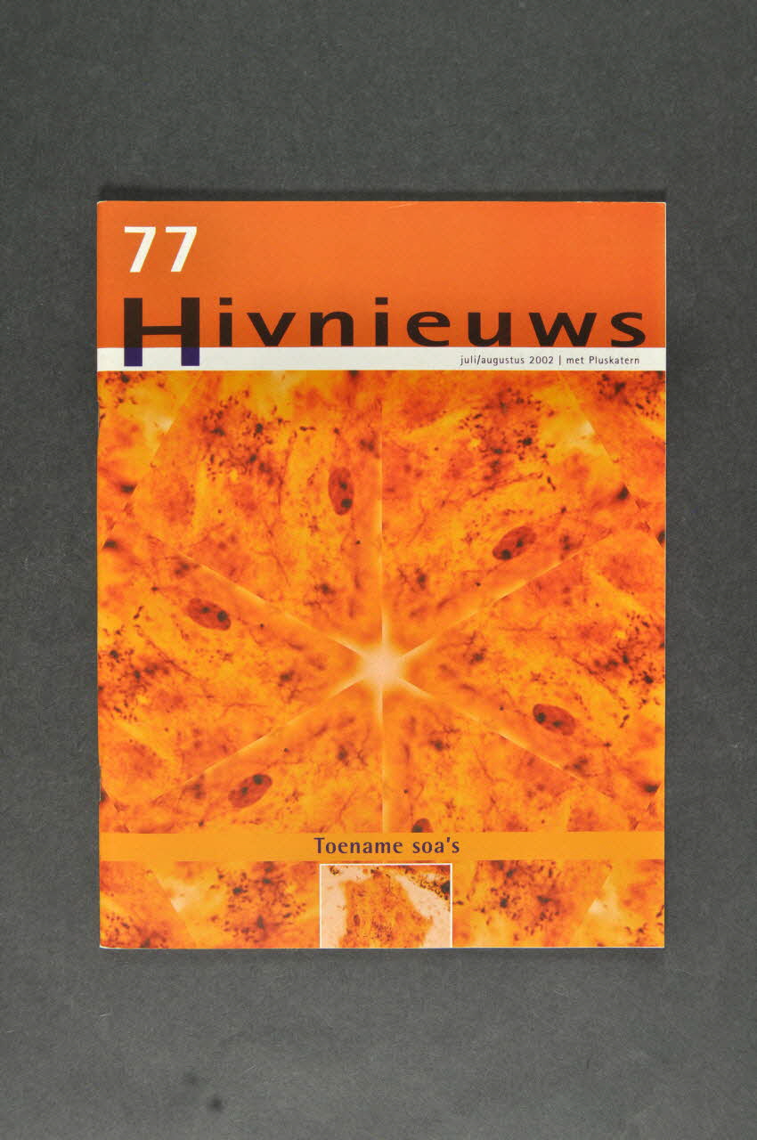 Hiv Vereniging Revue associative "Hivnieuws",  juillet août 2002, n° 77 / Toename soa's Pays-Bas 2002 2005.50.28 Photo Mucem