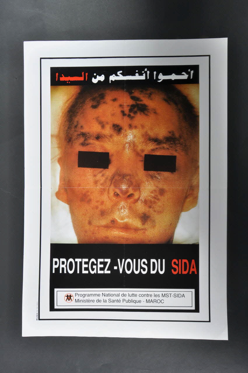 affiche "Protégez-vous du Sida" (kaposi) 2007.38.38 Photo Mucem